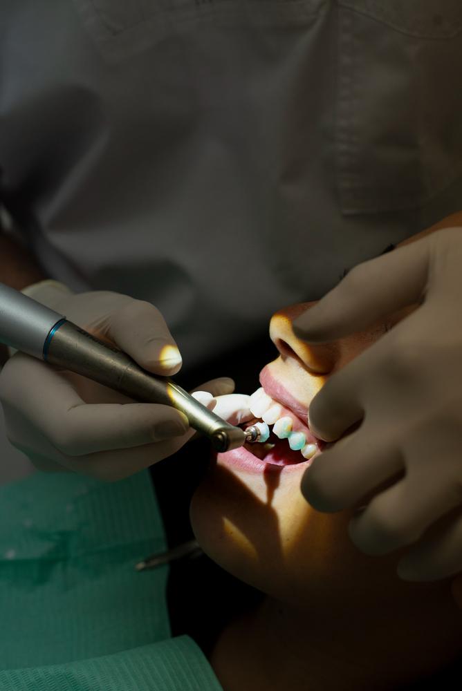 Un odontoiatra al lavoro durante una seduta
