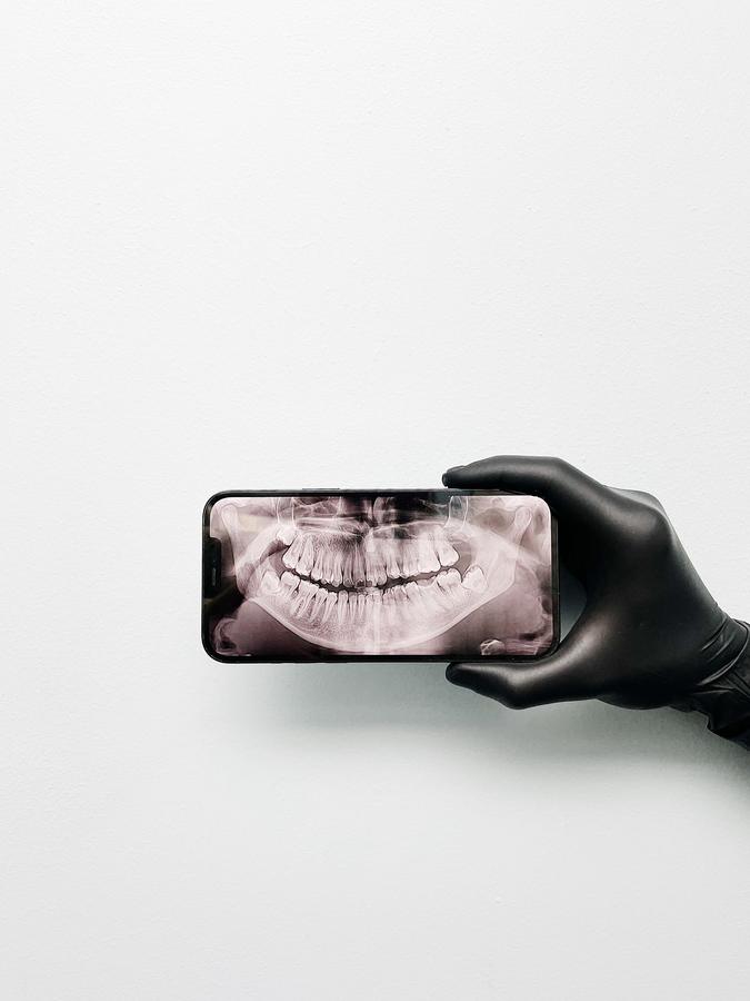 Una mano guantata mostra la radiografia panoramica su uno smartphone